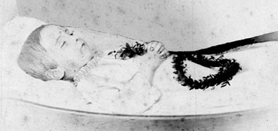Das 1869 verstorbene Söhnlein Friedrich v. Bodelschwingh auf dem Sterbebett